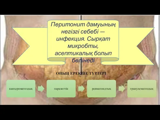 Перитонит дамуының негізгі себебі — инфекция. Сырқат микробты, асептикалық болып бөлінеді ОНЫҢ ЕРЕКШЕ ТҮРЛЕРІ