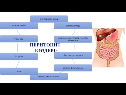 ПЕРИТОНИТ КӨЗДЕРІ: