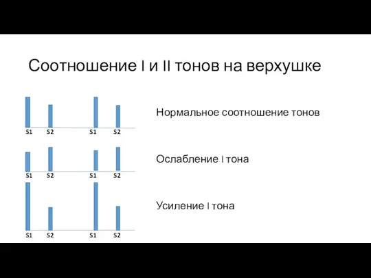 Соотношение I и II тонов на верхушке Нормальное соотношение тонов Ослабление I