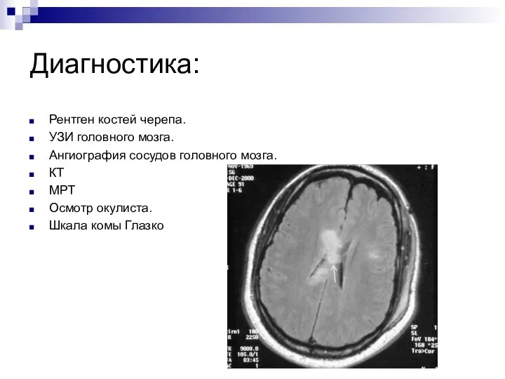 Диагностика: Рентген костей черепа. УЗИ головного мозга. Ангиография сосудов головного мозга. КТ
