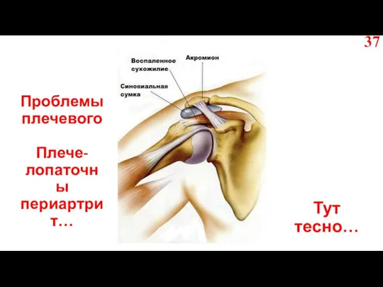 Проблемы плечевого Плече-лопаточны периартрит… Тут тесно…