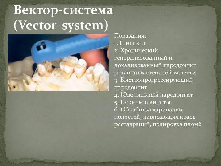 Вектор-система (Vector-system) Показания: 1. Гингивит 2. Хронический генерализованный и локализованный пародонтит различных