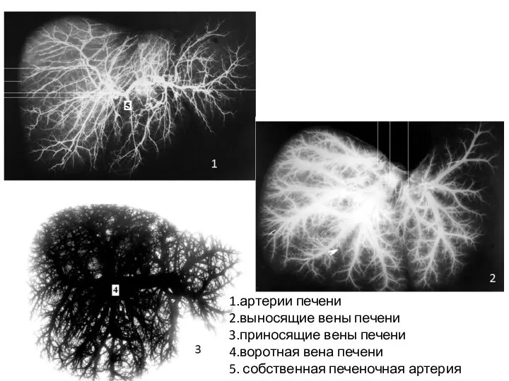 1 2 1.артерии печени 2.выносящие вены печени 3.приносящие вены печени 4.воротная вена