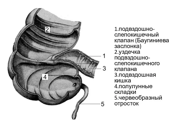 1.подвздошно-слепокишечный клапан (Баугиниева заслонка) 2.уздечка подвздошно-слепокишечного клапана 3.подвздошная кишка 4.полулунные складки 5.червеобразный отросток