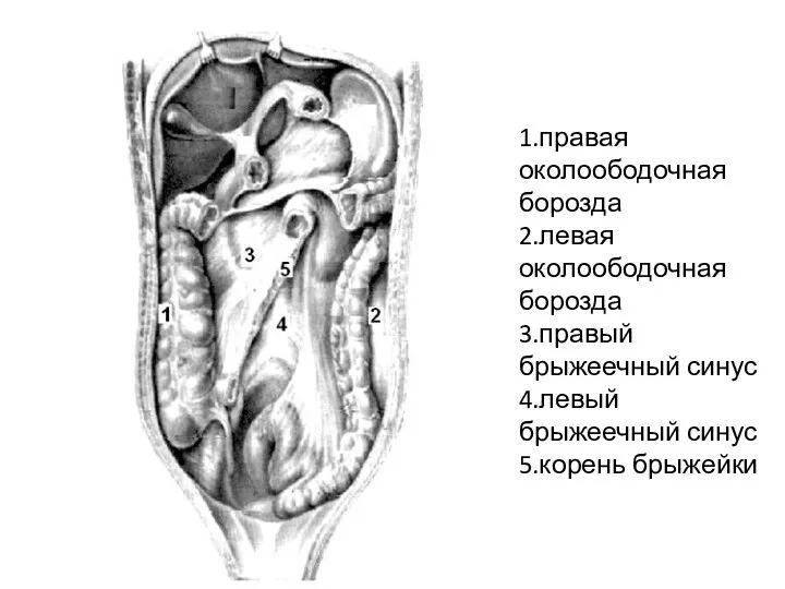 1.правая околоободочная борозда 2.левая околоободочная борозда 3.правый брыжеечный синус 4.левый брыжеечный синус 5.корень брыжейки