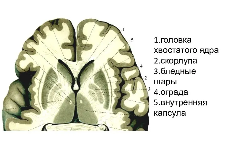 1.головка хвостатого ядра 2.скорлупа 3.бледные шары 4.ограда 5.внутренняя капсула