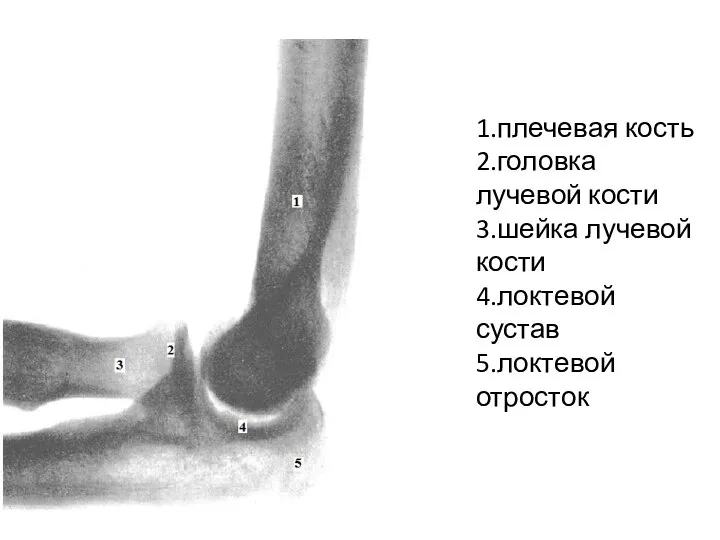 1.плечевая кость 2.головка лучевой кости 3.шейка лучевой кости 4.локтевой сустав 5.локтевой отросток