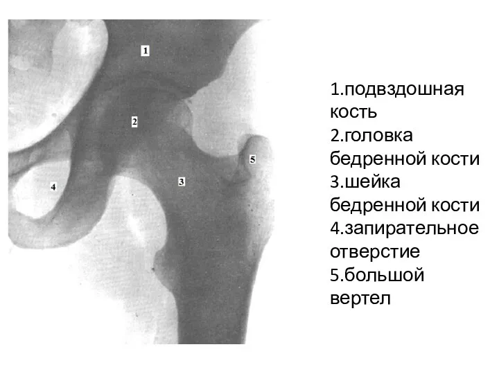 1.подвздошная кость 2.головка бедренной кости 3.шейка бедренной кости 4.запирательное отверстие 5.большой вертел