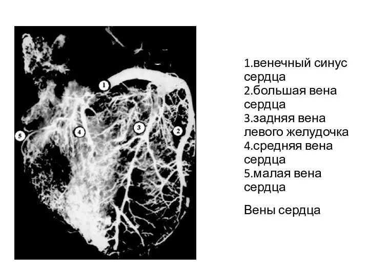 1.венечный синус сердца 2.большая вена сердца 3.задняя вена левого желудочка 4.средняя вена