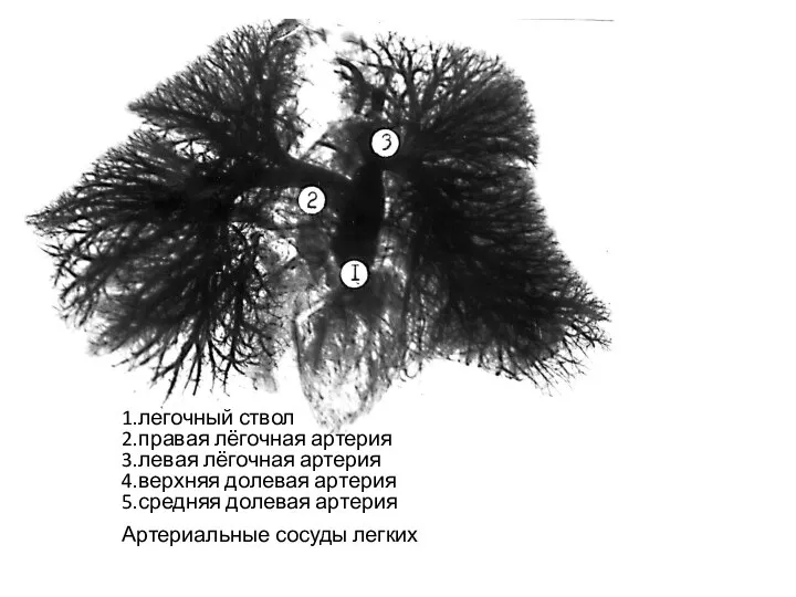 1.легочный ствол 2.правая лёгочная артерия 3.левая лёгочная артерия 4.верхняя долевая артерия 5.средняя