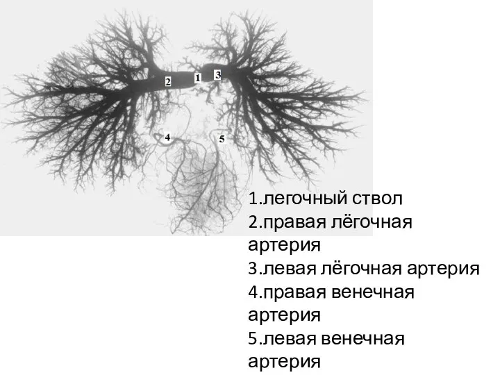 1.легочный ствол 2.правая лёгочная артерия 3.левая лёгочная артерия 4.правая венечная артерия 5.левая