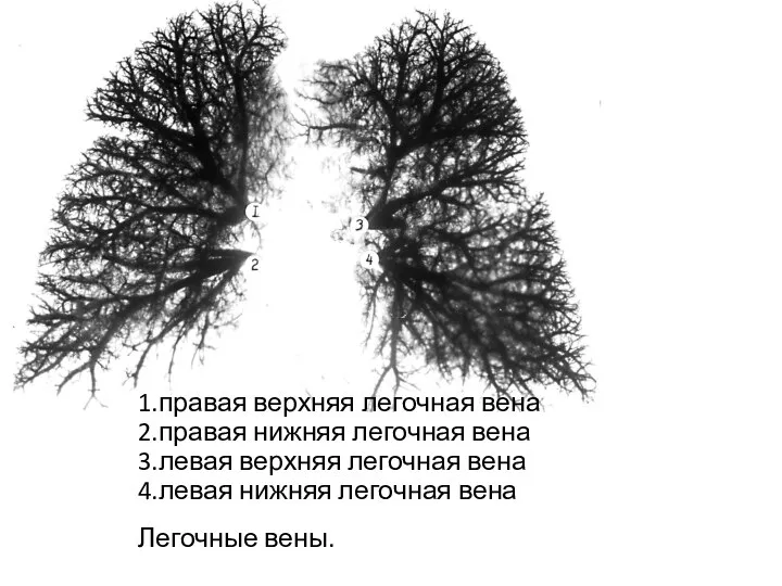 1.правая верхняя легочная вена 2.правая нижняя легочная вена 3.левая верхняя легочная вена