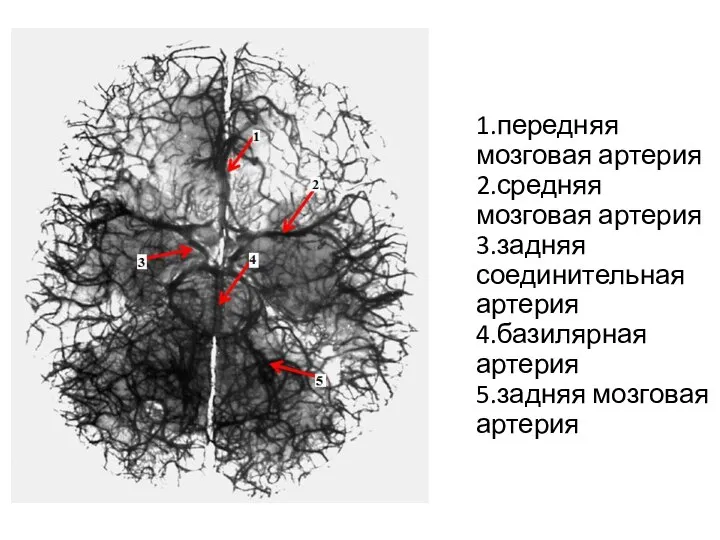 1.передняя мозговая артерия 2.средняя мозговая артерия 3.задняя соединительная артерия 4.базилярная артерия 5.задняя мозговая артерия