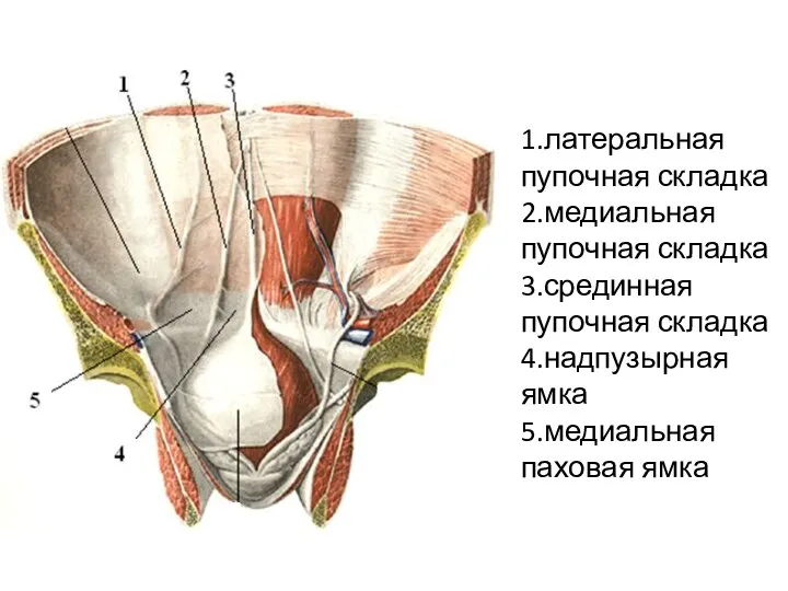 1.латеральная пупочная складка 2.медиальная пупочная складка 3.срединная пупочная складка 4.надпузырная ямка 5.медиальная паховая ямка