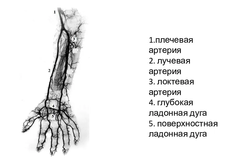 1.плечевая артерия 2. лучевая артерия 3. локтевая артерия 4. глубокая ладонная дуга 5. поверхностная ладонная дуга