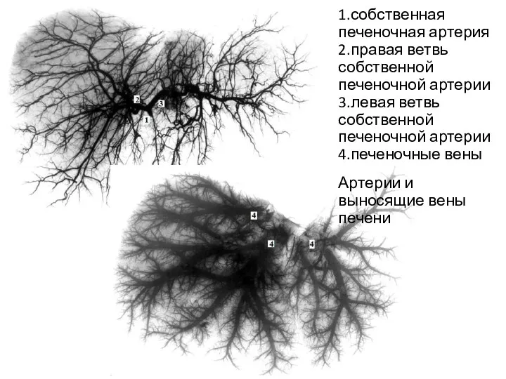 1.собственная печеночная артерия 2.правая ветвь собственной печеночной артерии 3.левая ветвь собственной печеночной