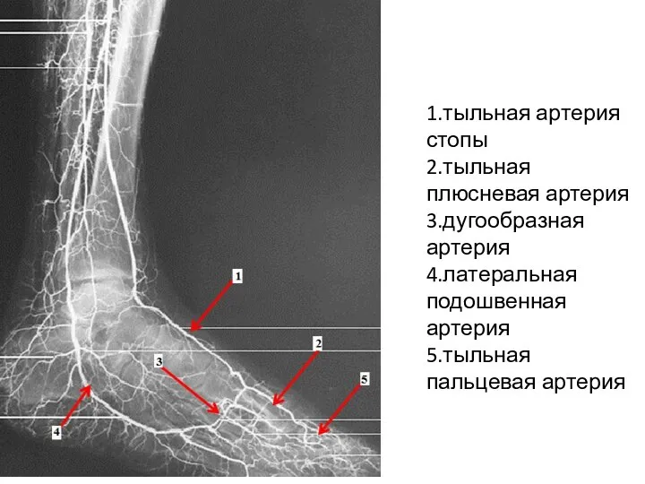 1.тыльная артерия стопы 2.тыльная плюсневая артерия 3.дугообразная артерия 4.латеральная подошвенная артерия 5.тыльная пальцевая артерия