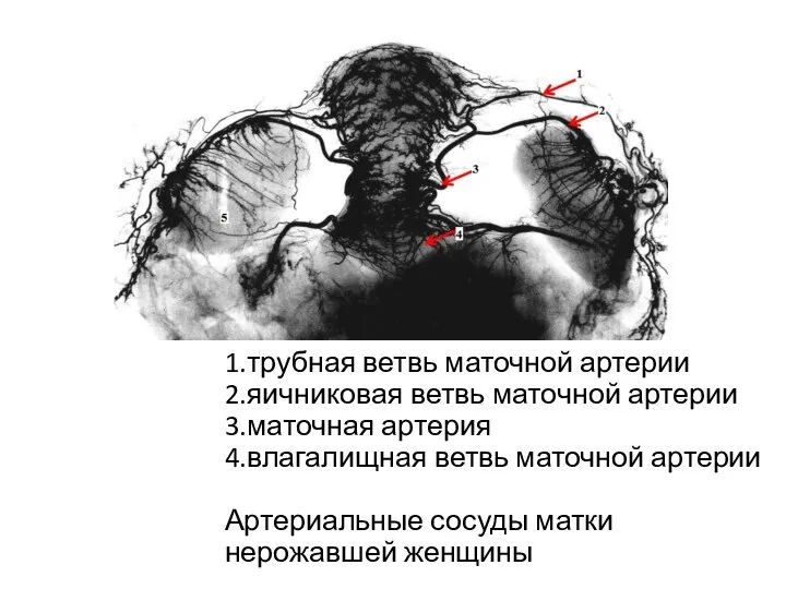 1.трубная ветвь маточной артерии 2.яичниковая ветвь маточной артерии 3.маточная артерия 4.влагалищная ветвь