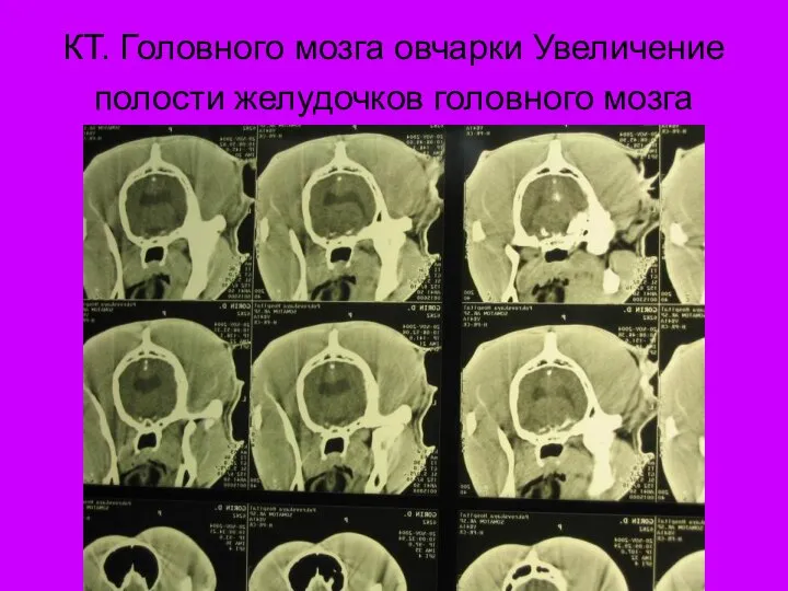 КТ. Головного мозга овчарки Увеличение полости желудочков головного мозга