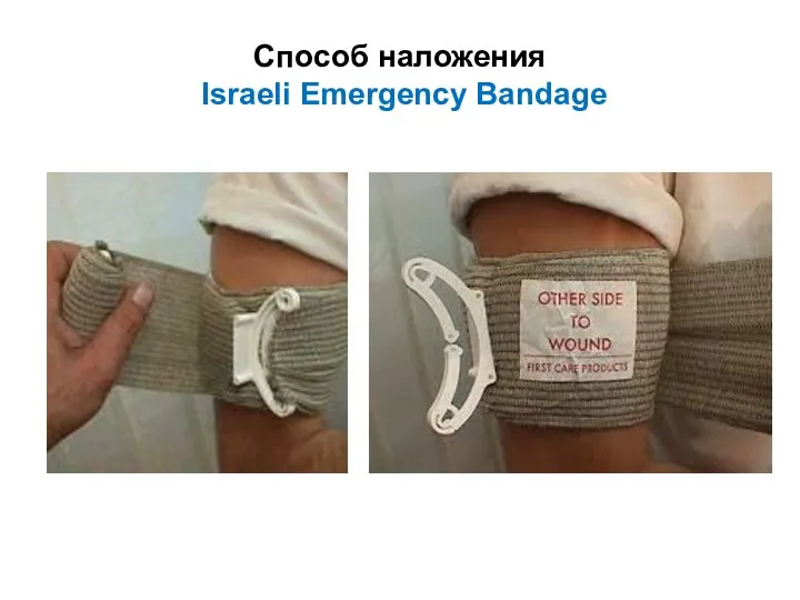 Способ наложения Israeli Emergency Bandage