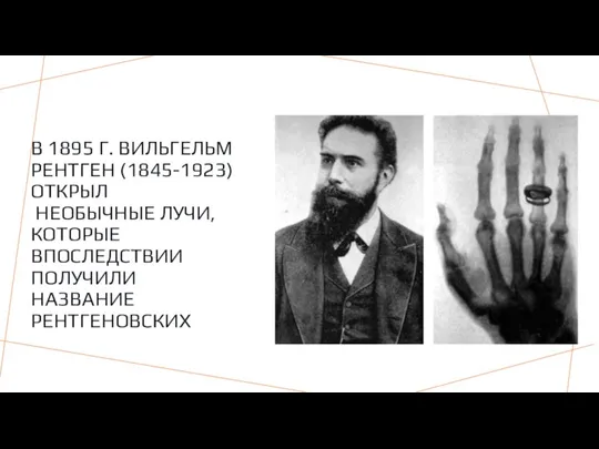 В 1895 Г. ВИЛЬГЕЛЬМ РЕНТГЕН (1845-1923) ОТКРЫЛ НЕОБЫЧНЫЕ ЛУЧИ, КОТОРЫЕ ВПОСЛЕДСТВИИ ПОЛУЧИЛИ НАЗВАНИЕ РЕНТГЕНОВСКИХ