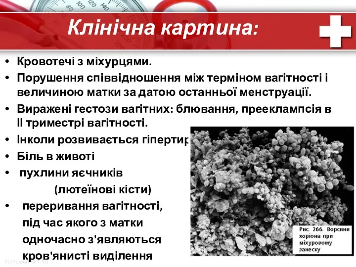 Клінічна картина: Кровотечі з міхурцями. Порушення співвідношення між терміном вагітності і величиною