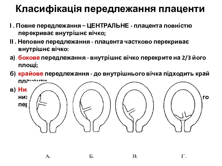 Класифікація передлежання плаценти І . Повне передлежання – ЦЕНТРАЛЬНЕ - плацента повністю