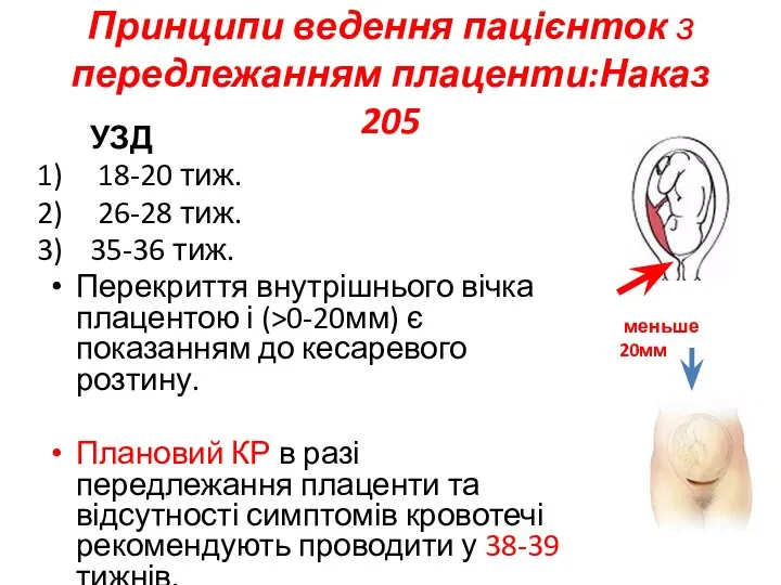 Принципи ведення пацієнток з передлежанням плаценти:Наказ 205 УЗД 18-20 тиж. 26-28 тиж.