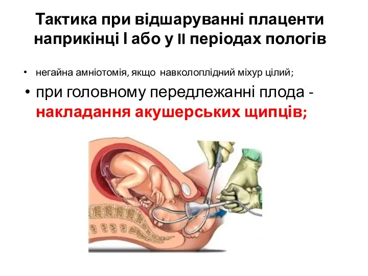 Тактика при відшаруванні плаценти наприкінці І або у II періодах пологів негайна
