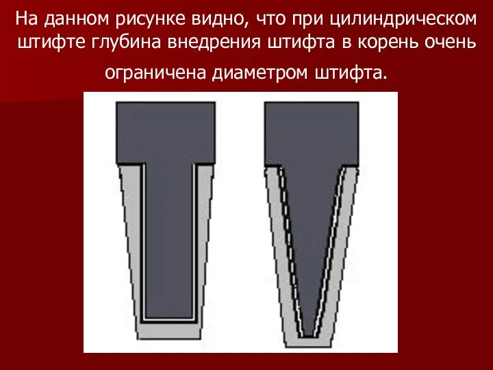 На данном рисунке видно, что при цилиндрическом штифте глубина внедрения штифта в