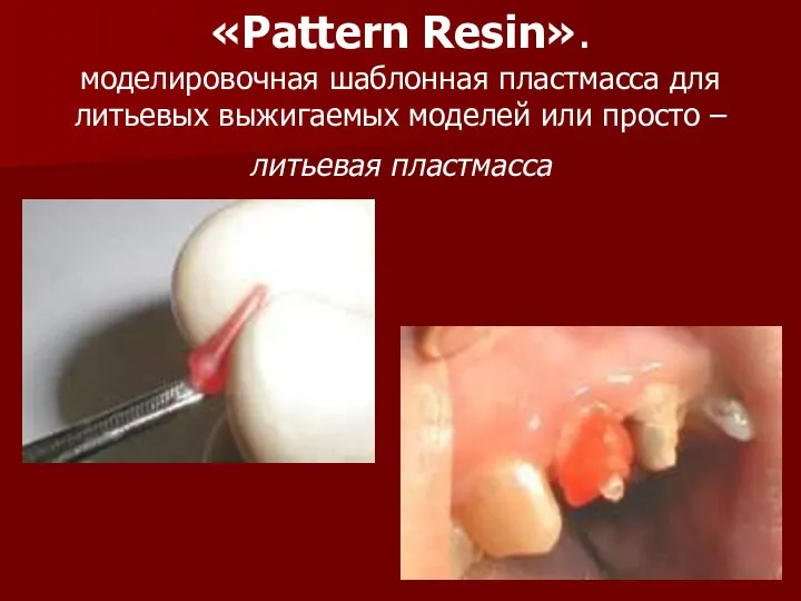 «Pattern Resin». моделировочная шаблонная пластмасса для литьевых выжигаемых моделей или просто – литьевая пластмасса