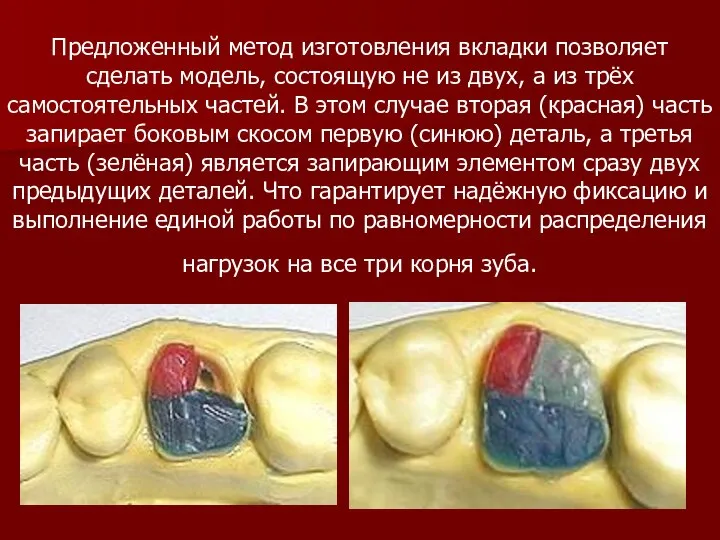 Предложенный метод изготовления вкладки позволяет сделать модель, состоящую не из двух, а