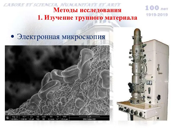 Методы исследования 1. Изучение трупного материала Электронная микроскопия