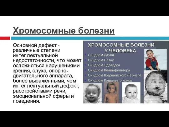 Хромосомные болезни Хромосомные болезни Основной дефект - различные степени интеллектуальной недостаточности, что