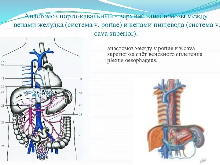 Анастомоз порто-кавальный.- верхний -анастомозы между венами желудка (система v. portae) и венами