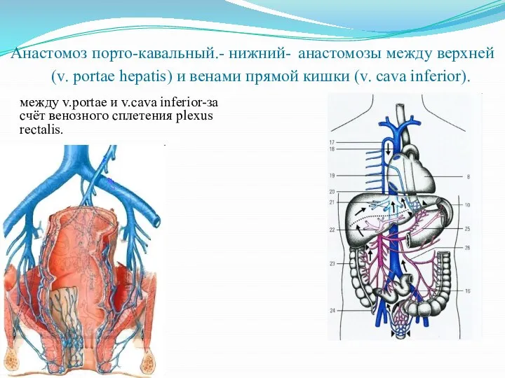 Анастомоз порто-кавальный.- нижний- анастомозы между верхней (v. portae hepatis) и венами прямой