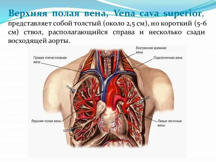 Верхняя полая вена, Vena cava superior, представляет собой толстый (около 2,5 см),