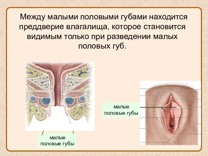 Между малыми половыми губами находится преддверие влагалища, которое становится видимым только при