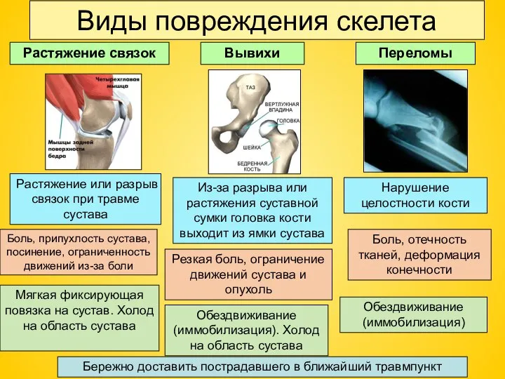 Виды повреждения скелета Растяжение связок Вывихи Переломы Боль, отечность тканей, деформация конечности