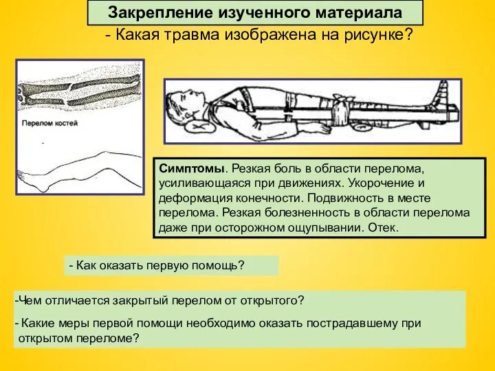 - Какая травма изображена на рисунке? Чем отличается закрытый перелом от открытого?