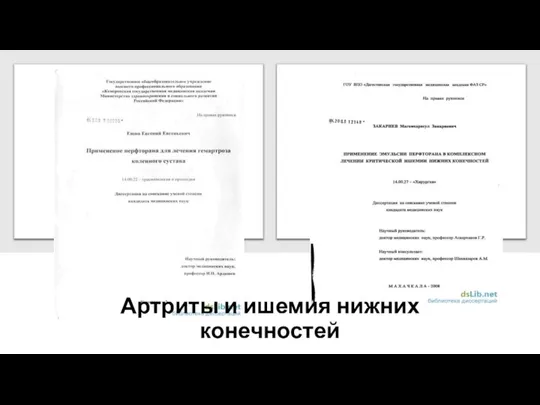 Артриты и ишемия нижних конечностей