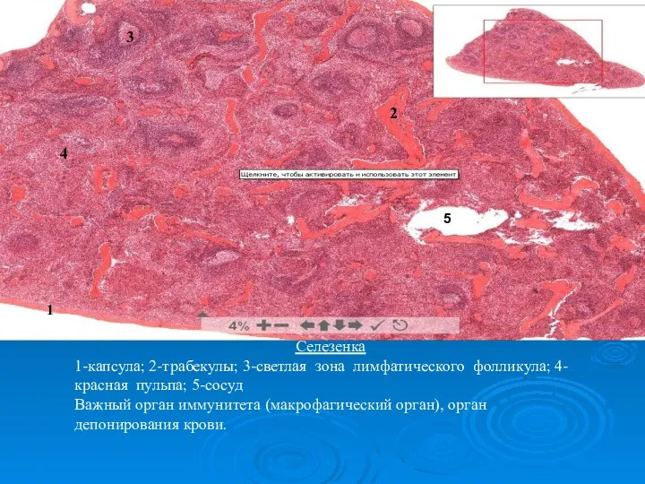 Селезенка 1-капсула; 2-трабекулы; 3-светлая зона лимфатического фолликула; 4-красная пульпа; 5-сосуд Важный орган