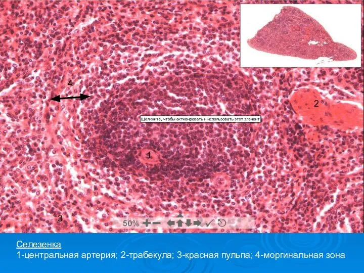1 2 3 4 Селезенка 1-центральная артерия; 2-трабекула; 3-красная пульпа; 4-моргинальная зона