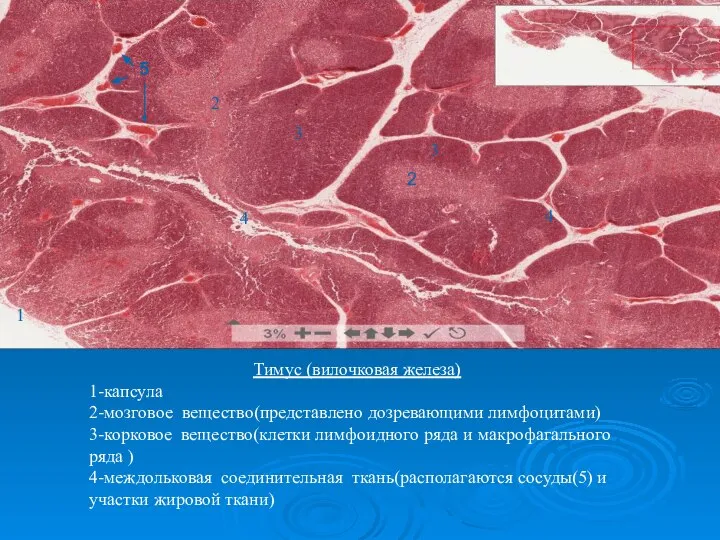 1 2 3 4 Тимус (вилочковая железа) 1-капсула 2-мозговое вещество(представлено дозревающими лимфоцитами)