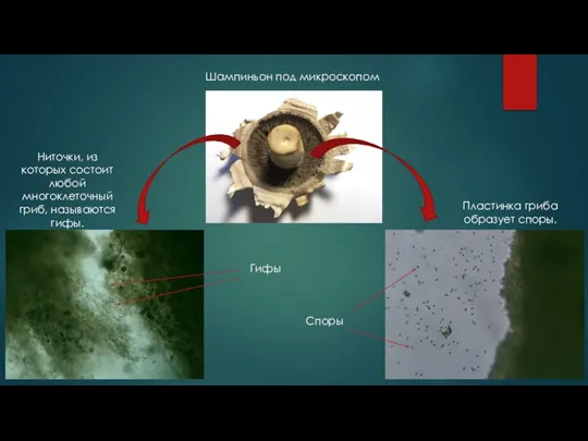 Шампиньон под микроскопом Ниточки, из которых состоит любой многоклеточный гриб, называются гифы.