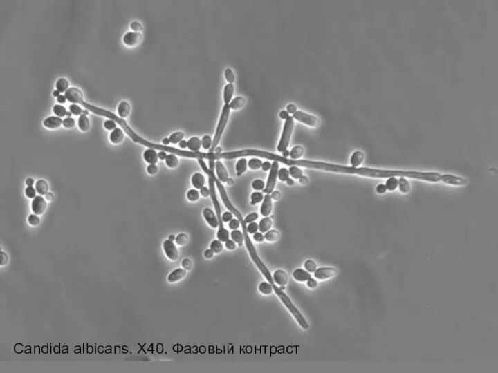 Candida albicans. X40. Фазовый контраст