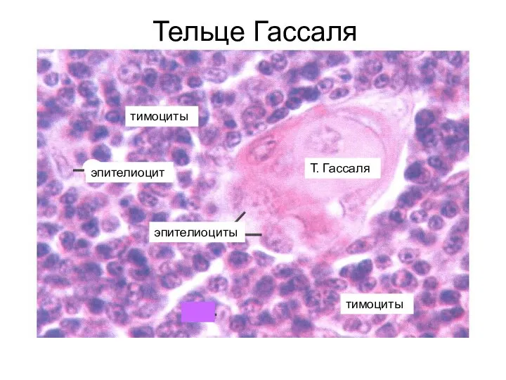 Тельце Гассаля тимоциты тимоциты эпителиоцит эпителиоциты Т. Гассаля