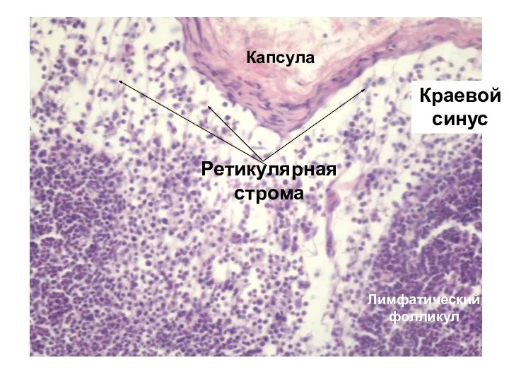 Ретикулярная строма Капсула Лимфатический фолликул Краевой синус