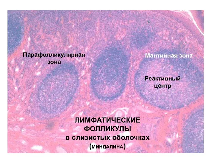 ЛИМФАТИЧЕСКИЕ ФОЛЛИКУЛЫ в слизистых оболочках (МИНДАЛИНА) Реактивный центр Мантийная зона Парафолликулярная зона