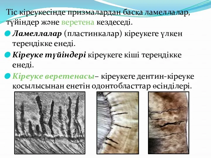 Тіс кіреукесінде призмалардан басқа ламеллалар, түйіндер және веретена кездеседі. Ламеллалар (пластинкалар) кіреукеге